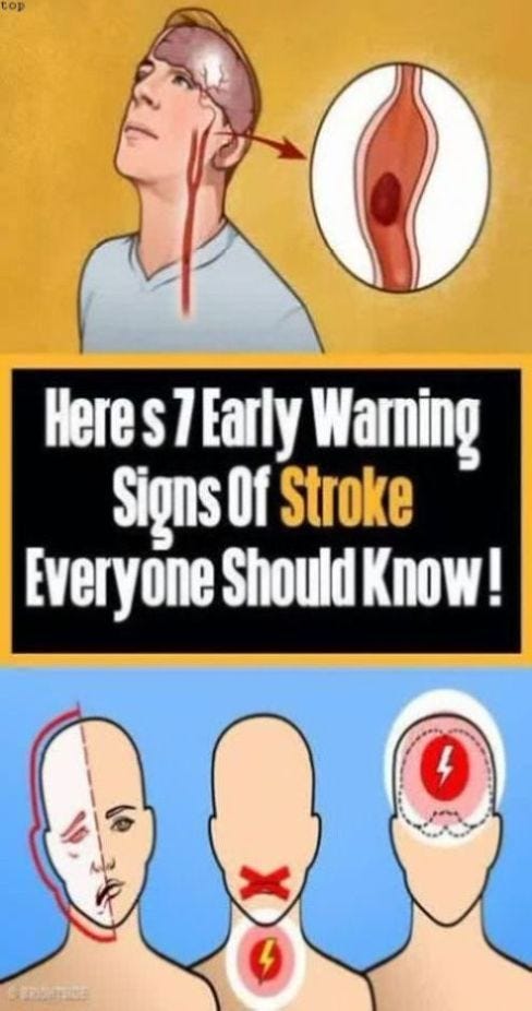 7 Incredibly True Warning Signs Of Stroke ! - Sarah Parsons - Medium