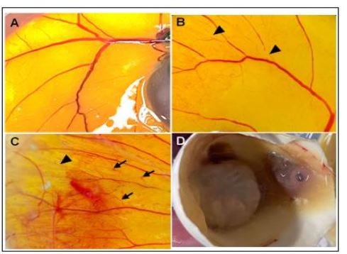 Evaluation of Antiangiogenic, Cytotoxic and In vitro Antiproliferative Activities of Alpinia…