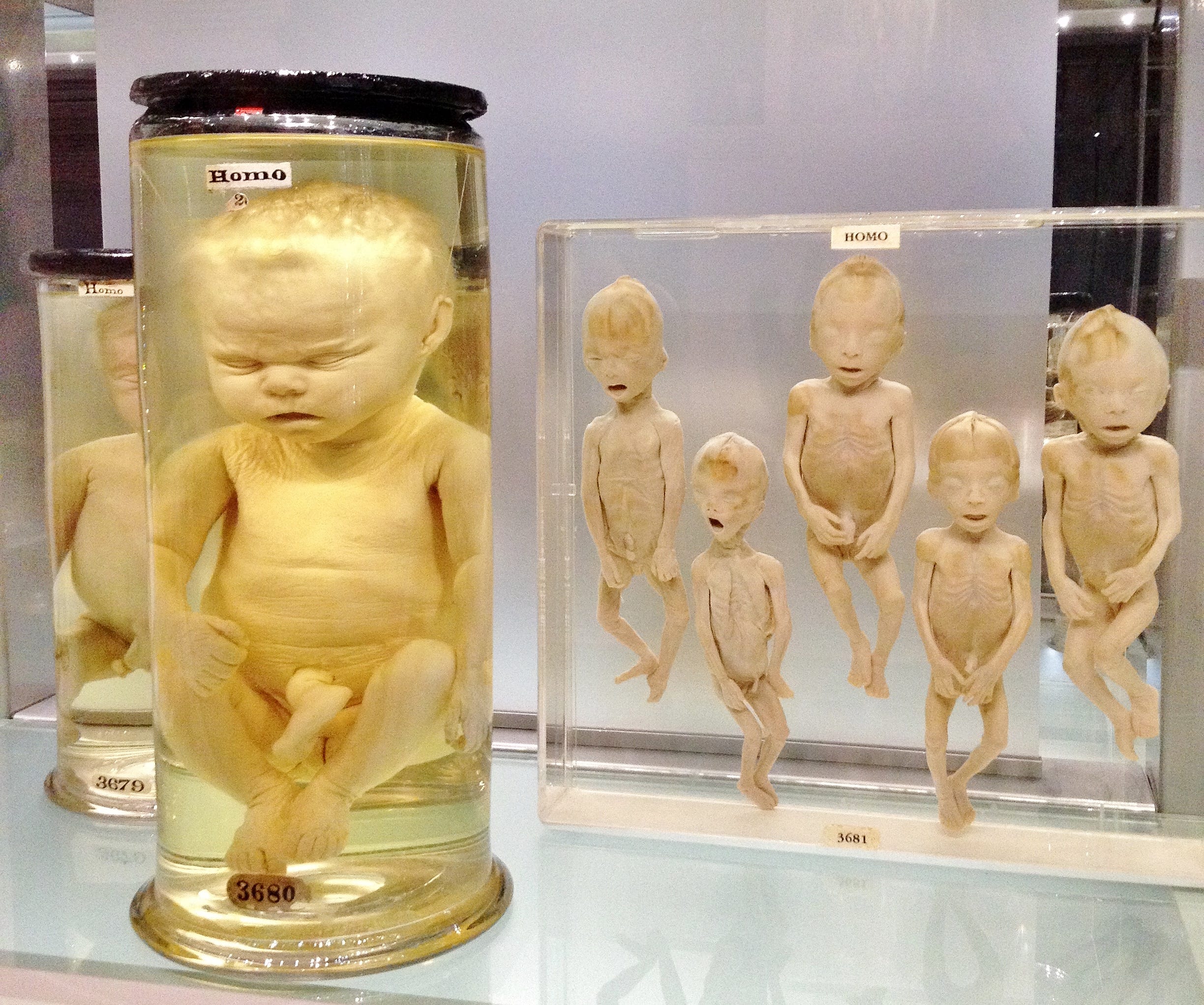 HUNTERIAN ART GALLERY: All You Need to Know BEFORE You Go (with Photos)