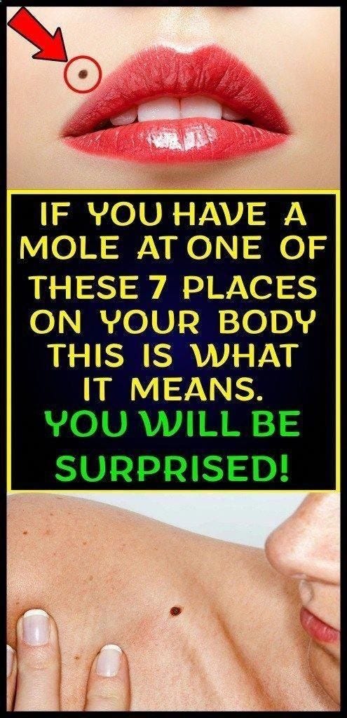 If You Have A Mole At One Of These 7 Places On Your Body This Is What It Means You Will Be 6792