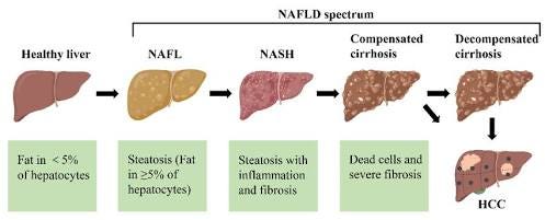 What Should People With Fatty Liver Eat Every Day? A Practical Fatty Liver Diet Guide