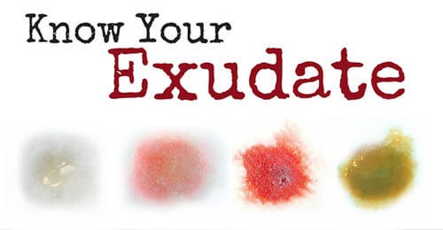 Weeping Wounds: Effective Strategies for Managing Exudate | by Sid Jackson  | The Eschar | Medium