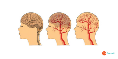 Traumatic Brain Injury Treatment in India | GoMedii | by GoMedii