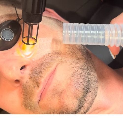 How Does Skin Resurfacing Winston Salem NC Help You Achieve Healthier Skin?