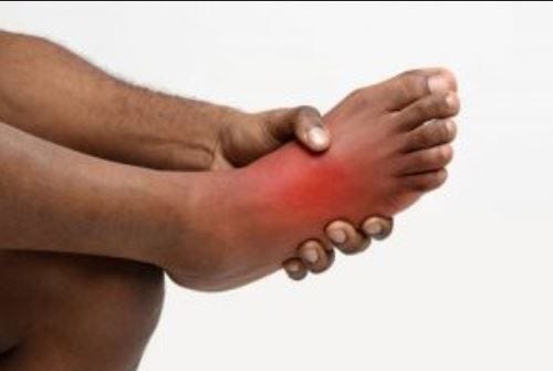 understanding-the-causes-of-a-painful-knot-on-top-of-your-foot-by