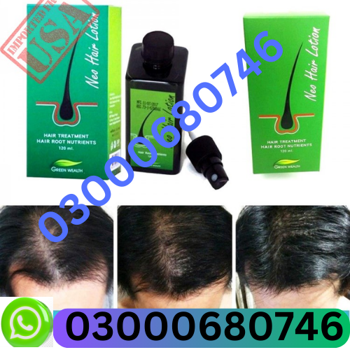 Neo Hair Lotion Price in Islamabad 03000680746 - Alizaali - Medium