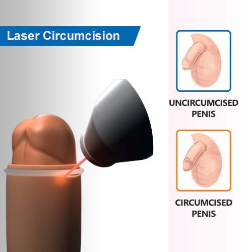 Circumcision Surgery in Jalandhar: Benefits, Risks
