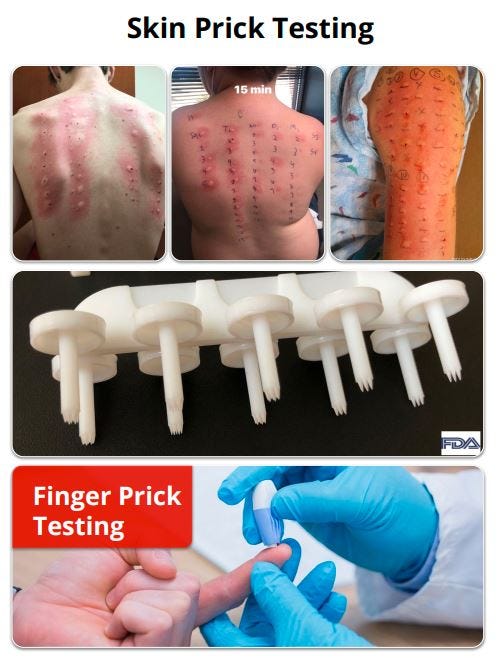 The Convenience of Skin Prick Allergy Tests Near You by Bird Dog