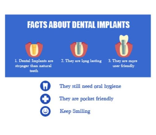 The Essentials of Dental Implants: Strength, Longevity, and Ease of Care | Best Dental Implants In Bangalore | by Beyondsmiles Indiranagar | Mar, 2024 | Medium