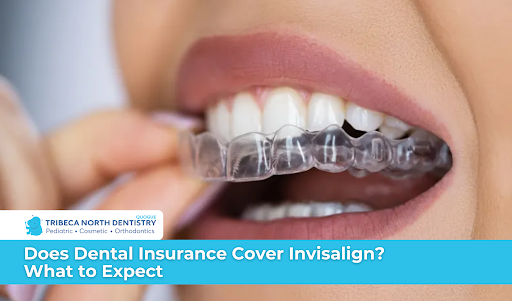 Does Dental Insurance Cover Invisalign? What to Expect