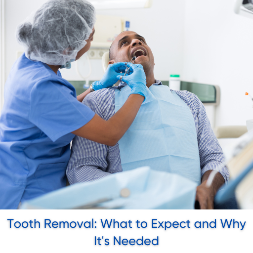 Tooth Removal What to Expect and Why It’s Needed by Premier