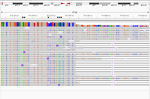 An example of the “problem” with SVs. This is a deletion labelled as 54 bp in the VCF file, starting at the midpoint of the image. But as you can see, not all deletions in this region are 54 bp long, and they don’t all start at the same position. The strictest decision would be to focus on exact matches, but there’ll always be a nagging what if feeling. E.g., What if the 53bp/52bp have the exact same effect but were misaligned?