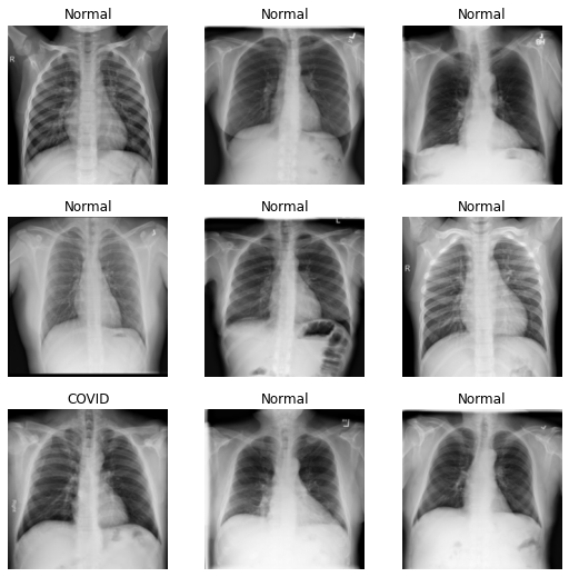 Covid19 Chest Xrays Classification using fastai Medium