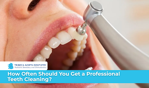 How Often Should You Get a Professional Teeth Cleaning?