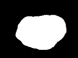 How to Build a U-Net for Melanoma Detection Using TensorFlow/Keras 5 melanoma-detection