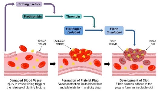 Hemophilia: a lack of clotting factors and the link to the Talmud