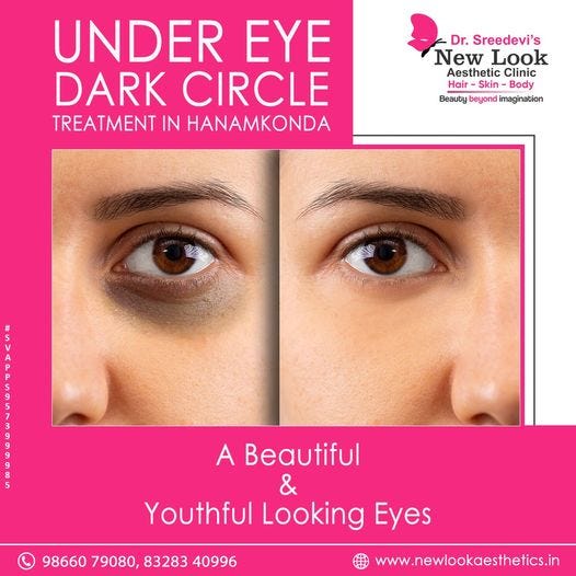 Under Eye Dark Circles Treatment in Hanamkonda Dr.Sreedevi's New Look