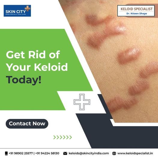 Get Rid of Keloid Keloidspecialist Medium