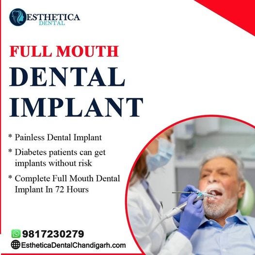 Experience Excellence Leading Dental Implant Specialist in Tricity at