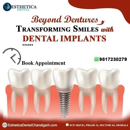 Revolutionizing Smiles Unveiling the Best Dental Implant Solutions at