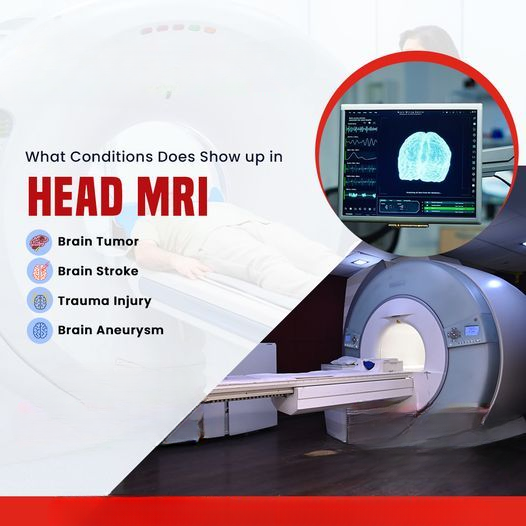 Unlocking the Power of MRI Scans: Sanjivini Diagnostics in Chandigarh ...