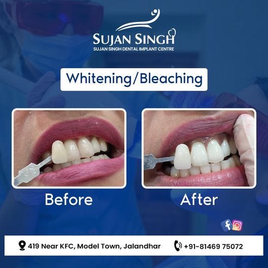 Best Dental Clinic in Jalandhar Sujan Singh Dental Implant Centre