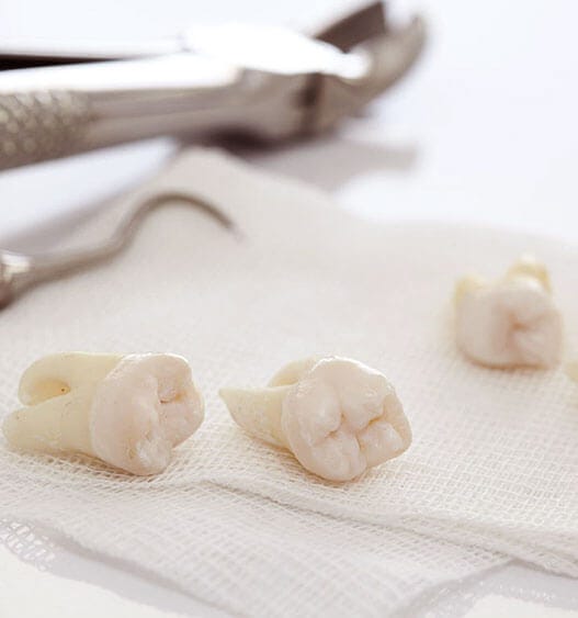 Tooth Extraction in Keller Abc 123 Dental Medium