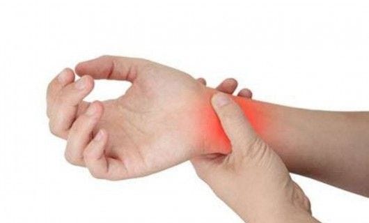 Artrite Reumatoide