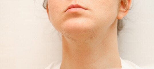 Chin Hair: 6 Embarrassing Red Flags No Woman Should Ever Ignore