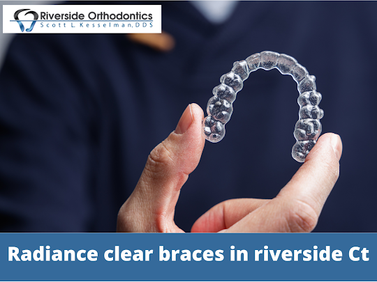 Radiance Clear Braces in Riverside Ct | by Riverside Orthodontics | Medium