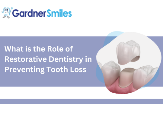 What is the Role of Restorative Dentistry in Preventing Tooth Loss