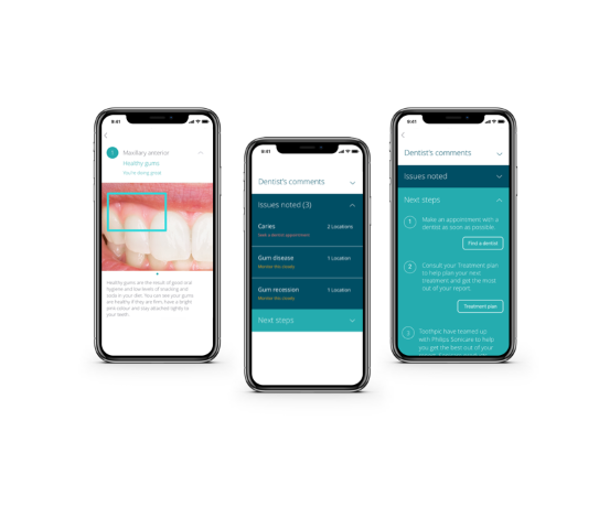 Teledental Technology: Techs and Balances | by Elaine Burke | OralEye ...