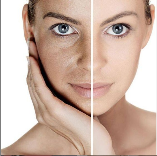 Best Way to Remove Dead Skin Cells by Elenalaurent Medium