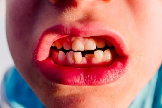 What Does It Mean to Dream About Losing Your Teeth? | by Decoding