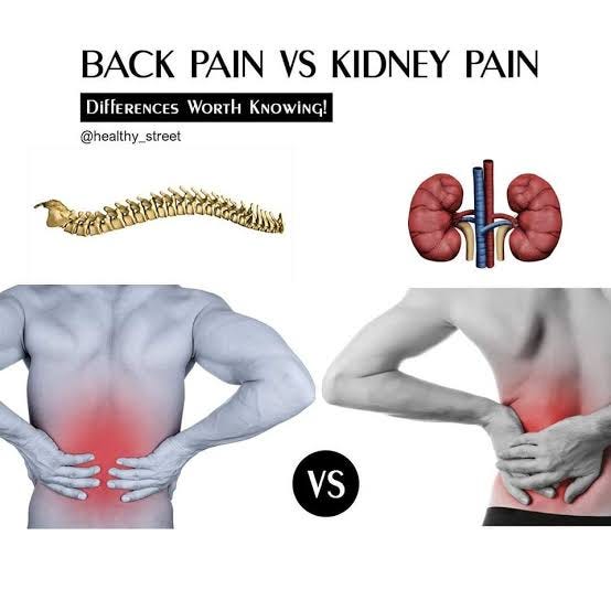 causes of kidney pain. Kidney pain by Kanwal Tufail Oct, 2024 Medium
