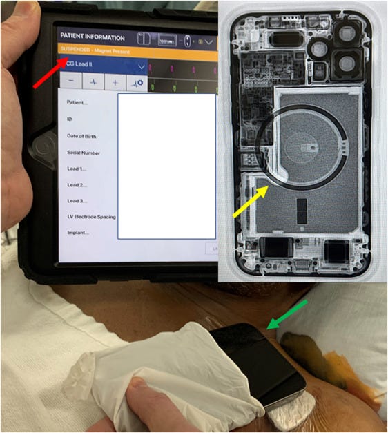 Consomac : iPhone 12 : les aimants de MagSafe dangereux pour les pacemakers  ?