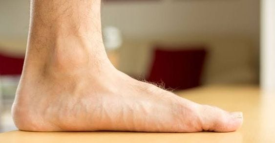 The Impact of Flat Feet Insoles on Injury Prevention
