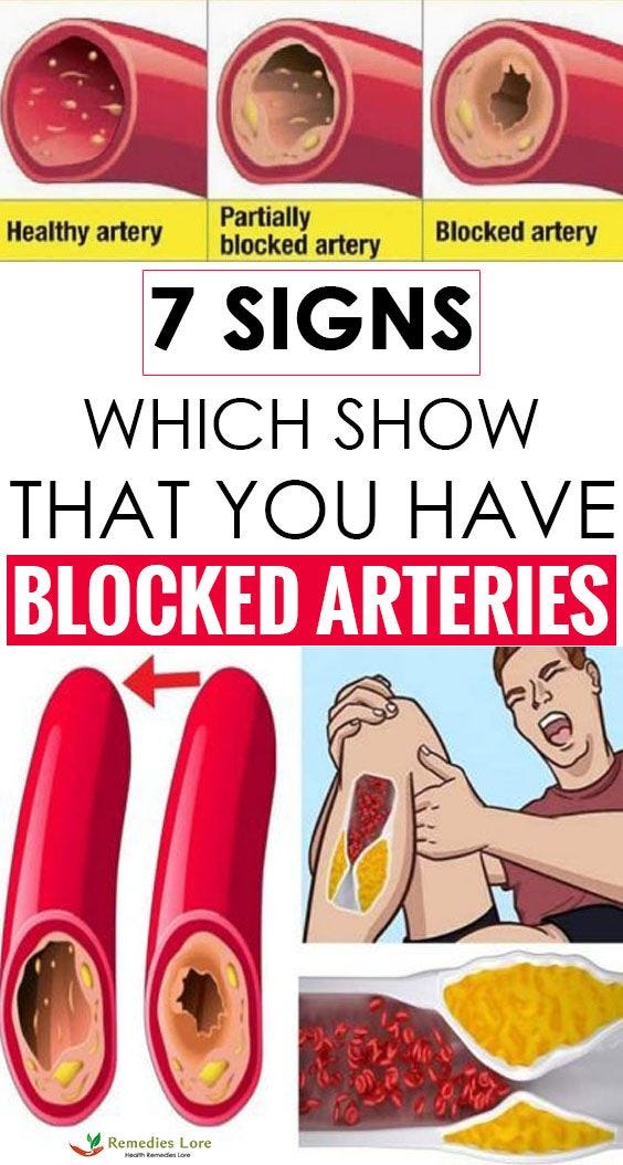 6 Warning Signs of Clogged Arteries Cintia Mire Medium