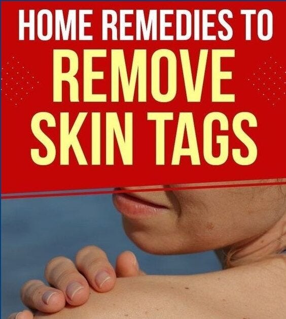 How to Remove Skin Tag healthystyle Medium