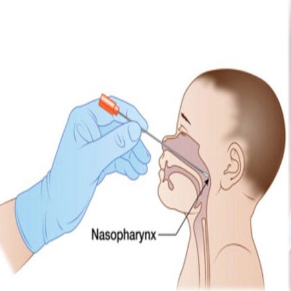 How is the Sample Collected for RSV Testing? by Meidike Gene Medium
