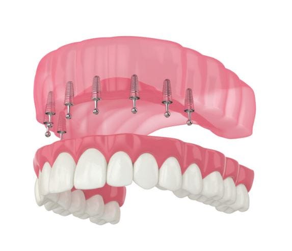 Snap On Dentures Terry Rivera Medium   1*0dKMLm6jUpx3nXWBUSvOHw 