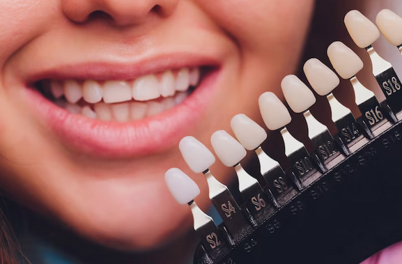 Transform Your Smile with Dental Veneers in Corbin