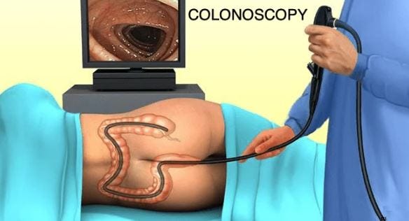 What is Colonoscopy?. A colonoscopy or colonoscopy screening… | by Dr.Astha  Bhatt | Medium