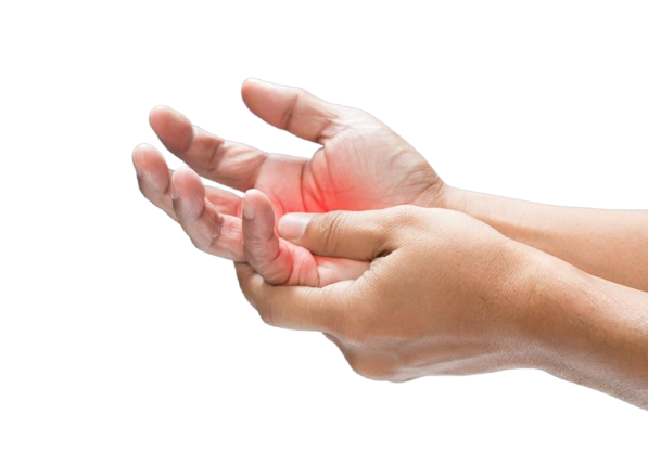 Dupuytren’s Contracture: Exploring New Treatment Options for Palmar Fibromatosis