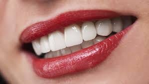 Best Dental Veneers for Long-Lasting Results: What to Look for in Quality  Veneers | by Amiralijoiya | Aug, 2024 | Medium