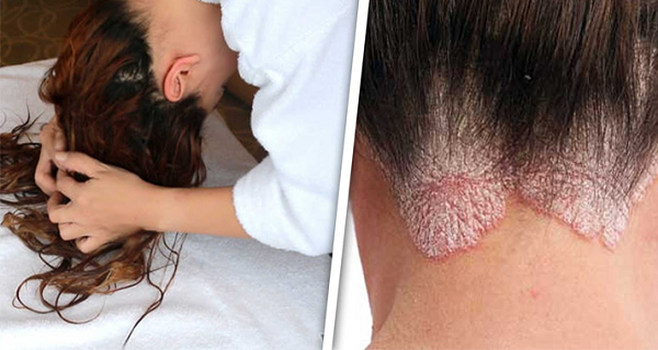 7 Diseases That Are Caused By Sleeping With Wet Hair. Stop Doing It Right Now! | by CelebrityQizz | Medium