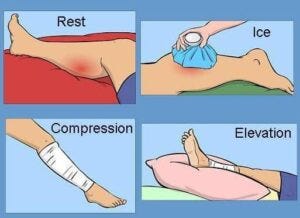 Endometriosis: Understanding Symptoms and Management Options at