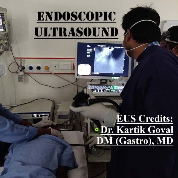 Best Endoscopy Doctor in Ludhiana Pinkysharmachopra Medium