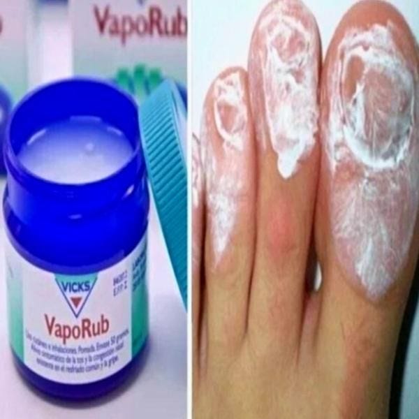 “3Minute Shower Hack” To Remove Fungus Fast And Effectively Sophia