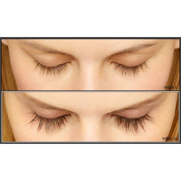 Ways to Deal with Short and Brittle Eyelashes by Glory white Medium